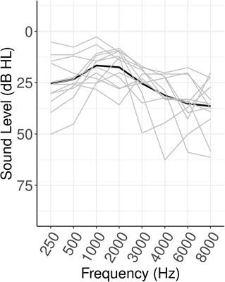 Listening Over Time: Single-Trial Tonic and Phasic Oscillatory Alpha-and Theta-Band Indicators of Listening-Related Fatigue